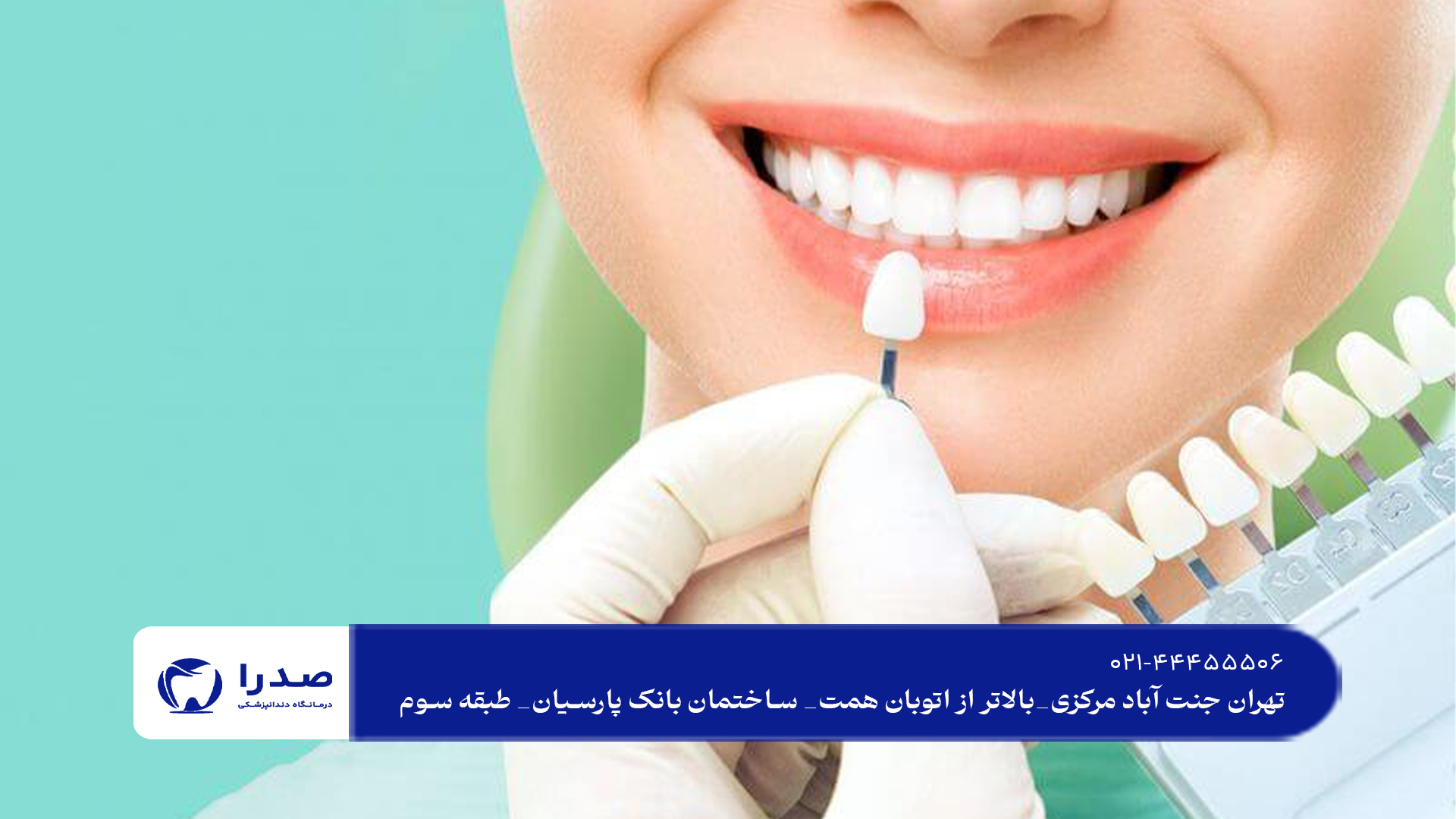 لمینت دندان در سعادت آباد