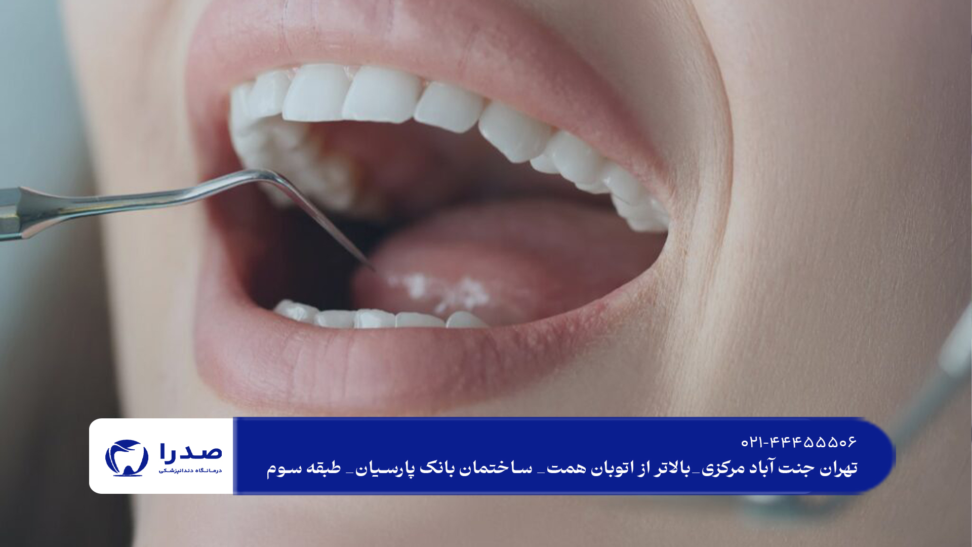 مرکز دندانپزشکی زیبایی در تهران مرکز دندانپزشکی زیبایی در تهران