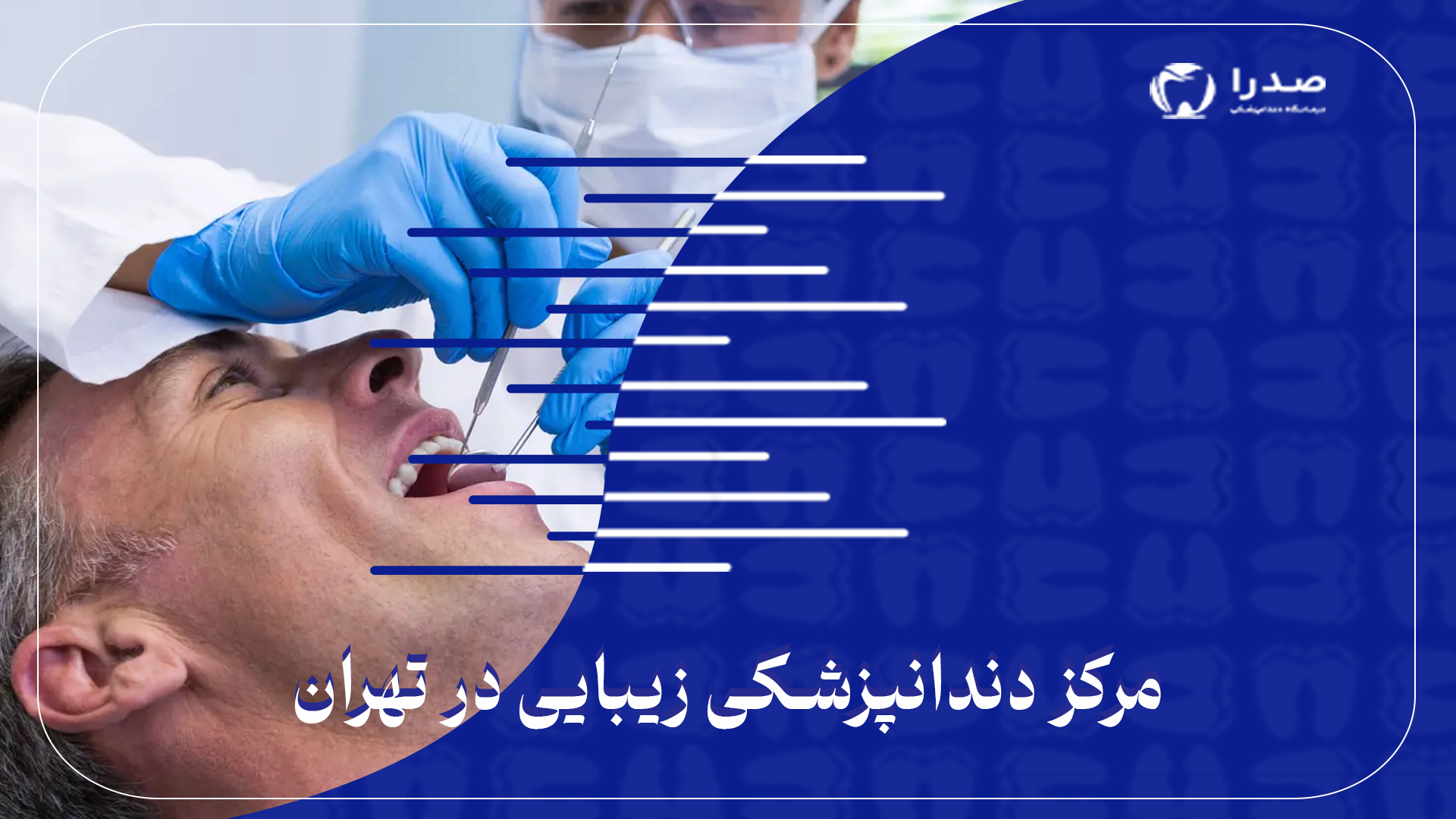 دندانپزشکی زیبایی دندانپزشکی زیبایی