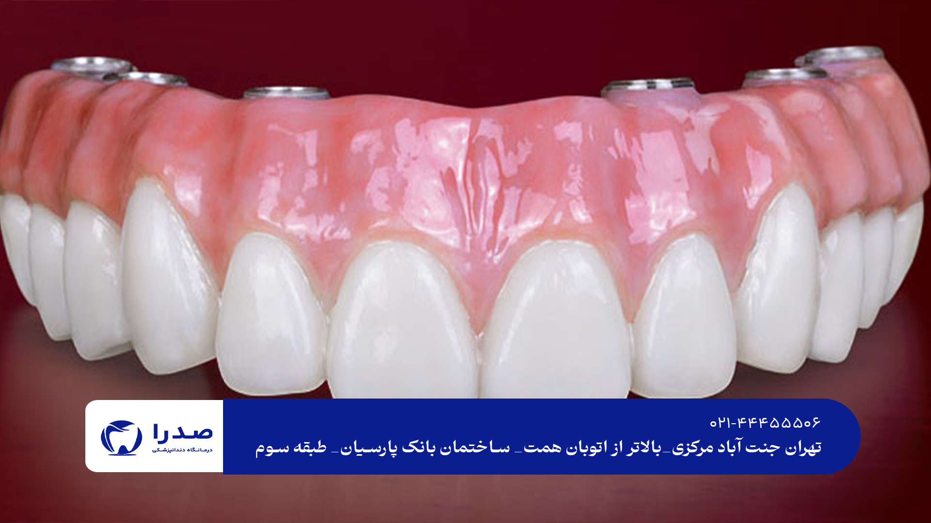 پروتز ثابت و متحرک دندان