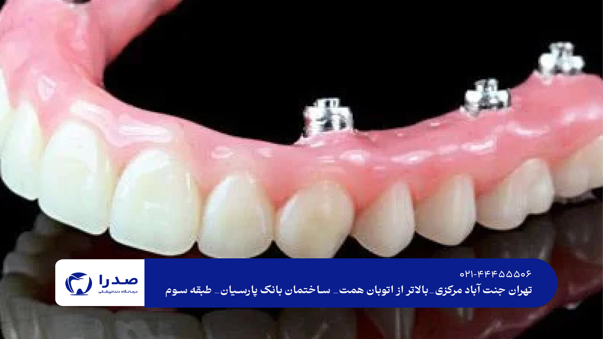 پروتز ثابت و متحرک دندان پروتز ثابت و متحرک دندان