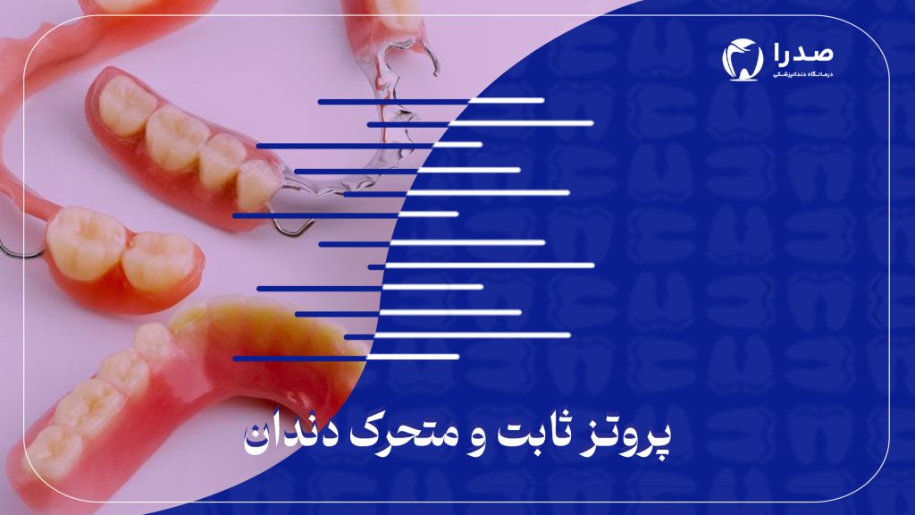پروتز ثابت و متحرک دندان