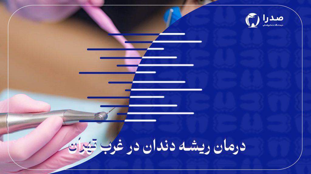 درمان ریشه دندان در غرب تهران