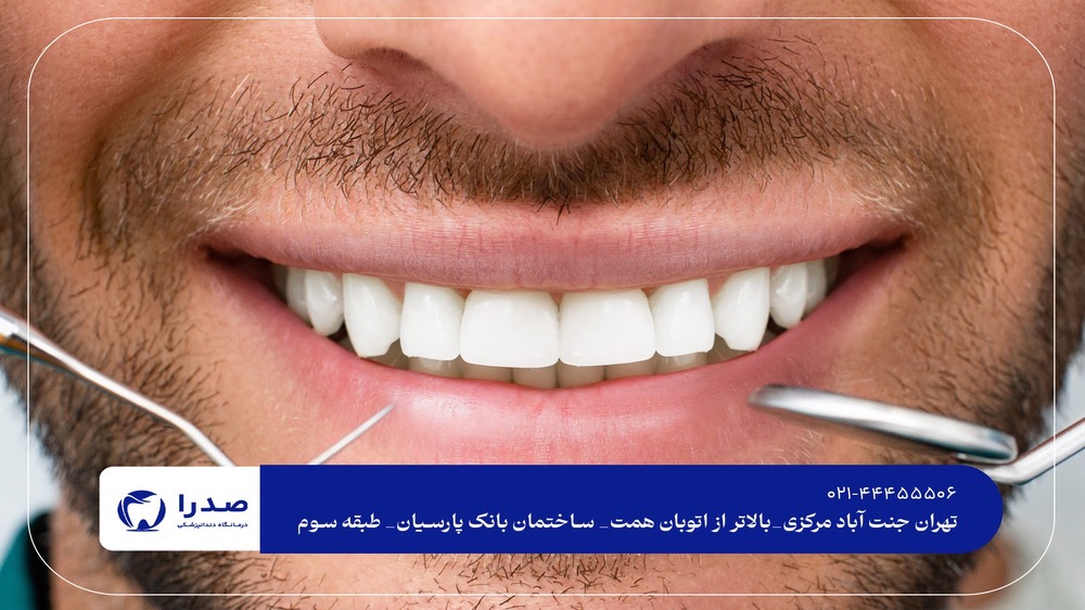 دندان پزشکی در جنت آباد