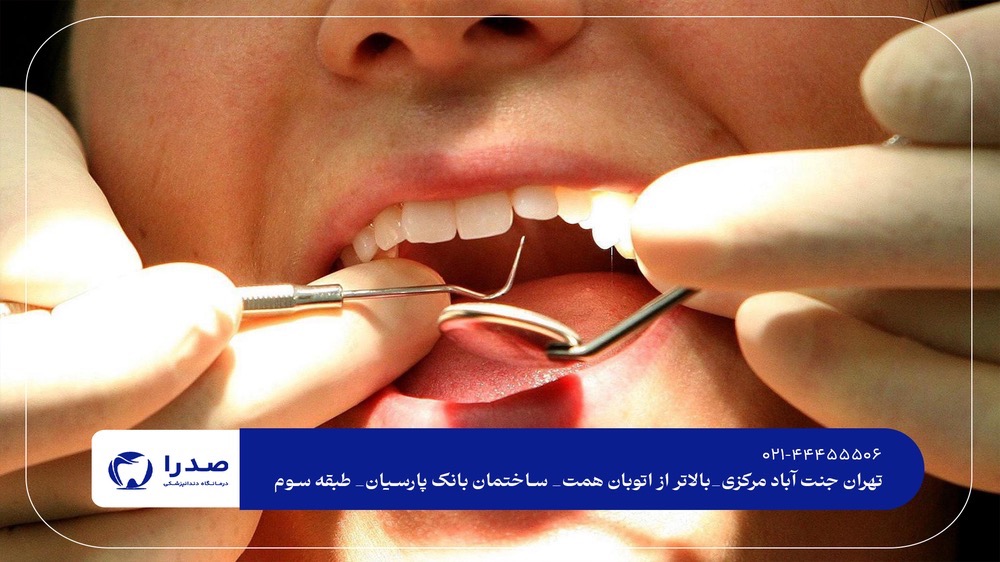 دندان پزشکی در جنت آباد دندان پزشکی در جنت آباد