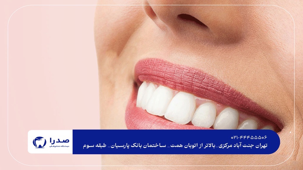 دندانپزشک زیبایی در غرب تهران