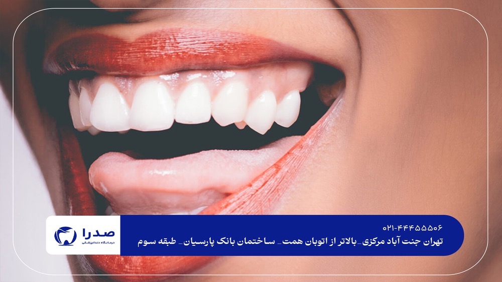 دندانپزشک زیبایی در غرب تهران دندانپزشک زیبایی در غرب تهران