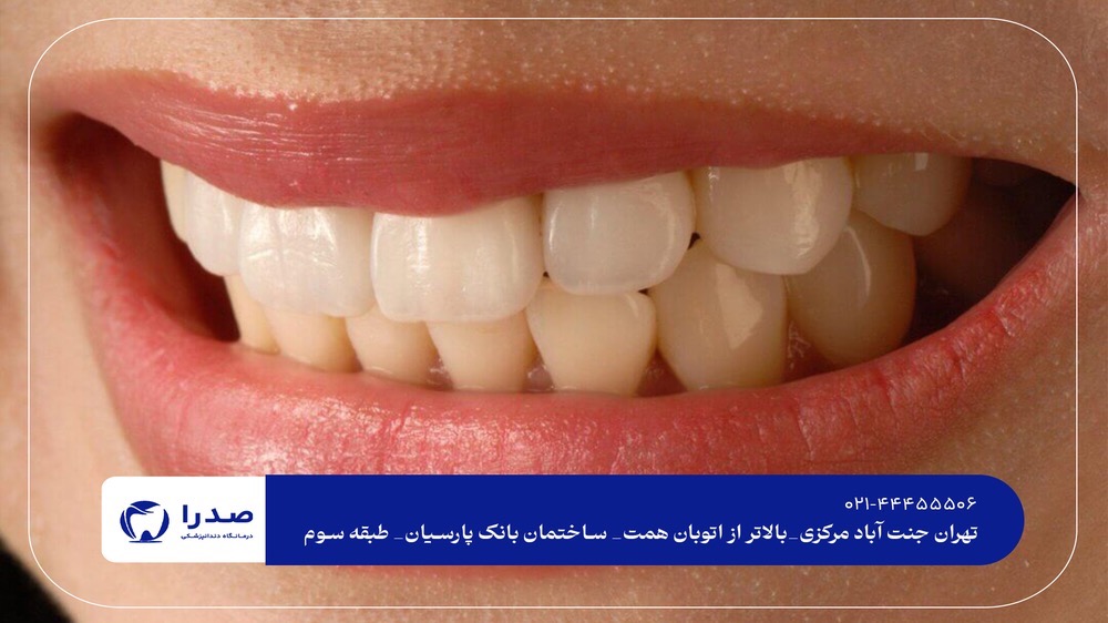 دندانپزشک زیبایی در غرب تهران دندانپزشک زیبایی در غرب تهران