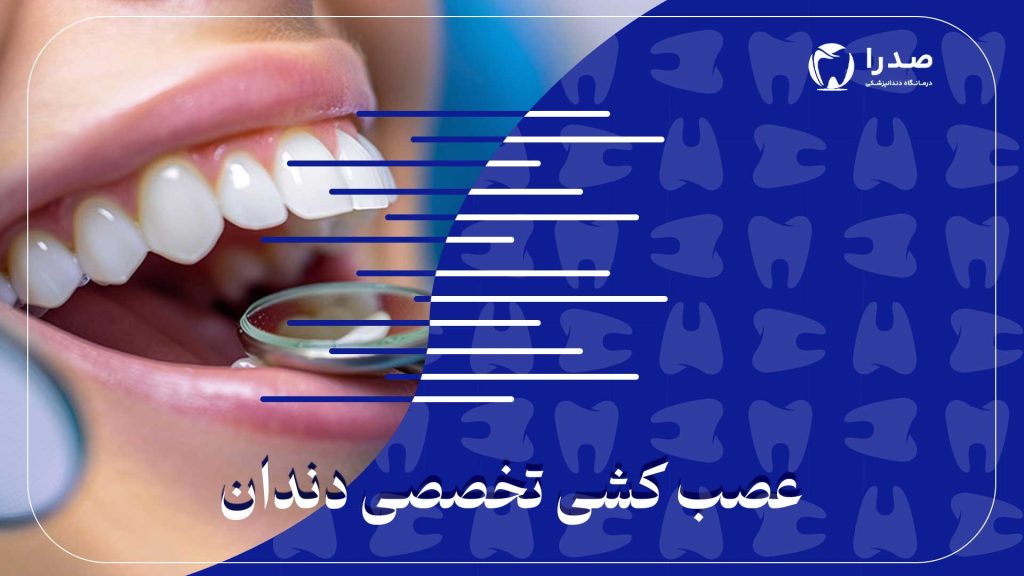 تفاوت پرکردن و عصبکشی دندان