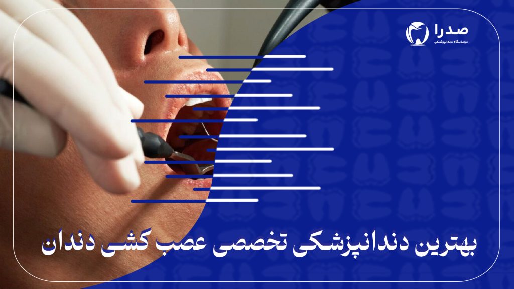 بهترین دندانپزشکی تخصصی عصب کشی دندان