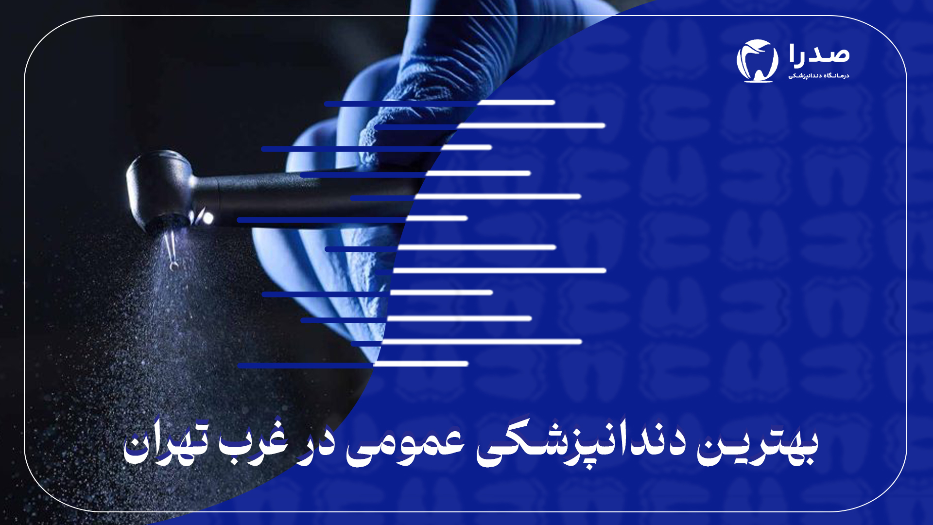 بهترین دندانپزشکی عمومی در غرب تهران بهترین دندانپزشکی عمومی در غرب تهران