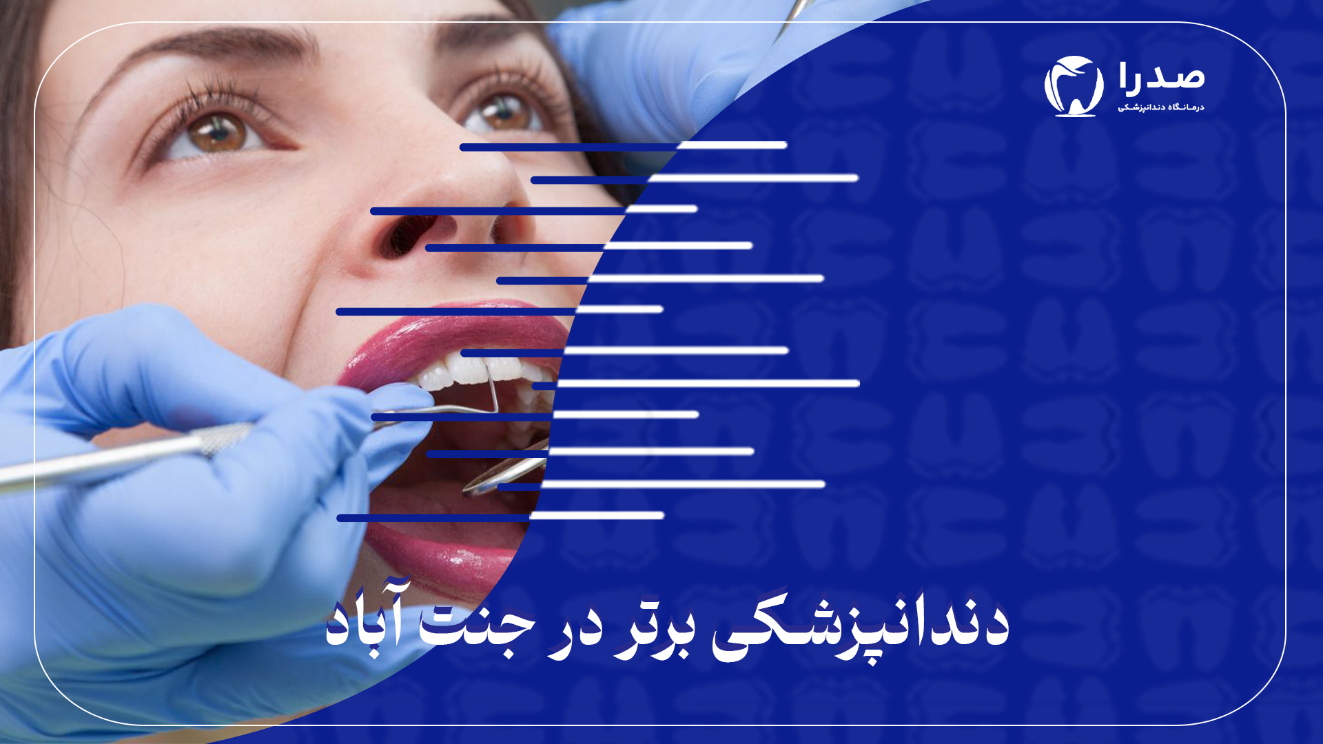 دندانپزشکی برتر در جنتآباد دندانپزشکی برتر در جنتآباد