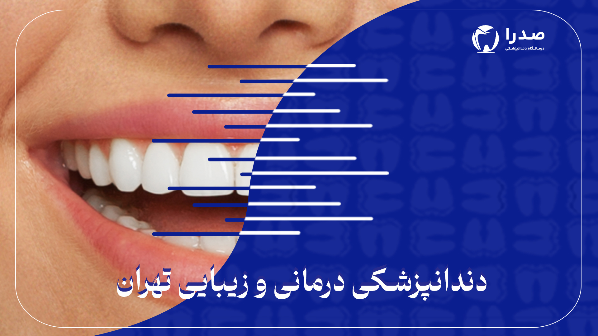 دندانپزشکی درمانی و زیبایی تهران دندانپزشکی درمانی و زیبایی تهران