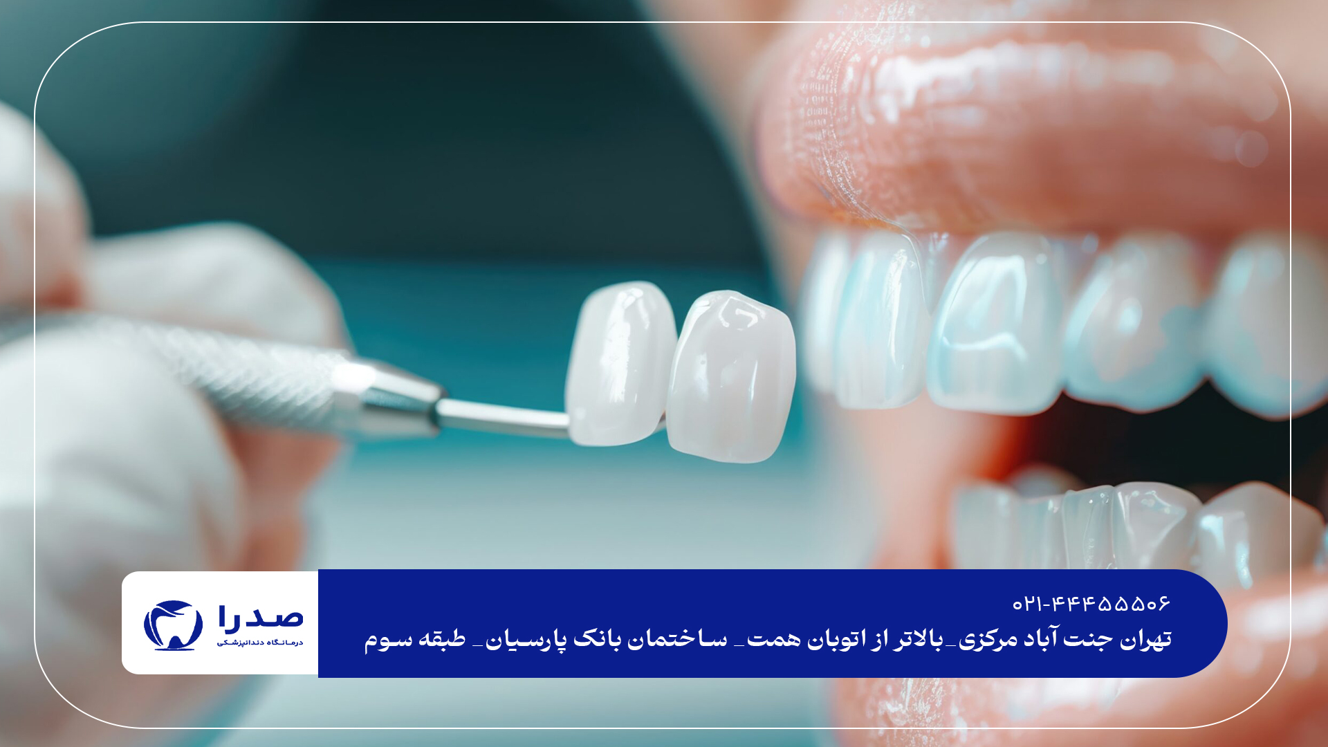 دندانپزشکی درمانی و زیبایی تهران دندانپزشکی درمانی و زیبایی تهران