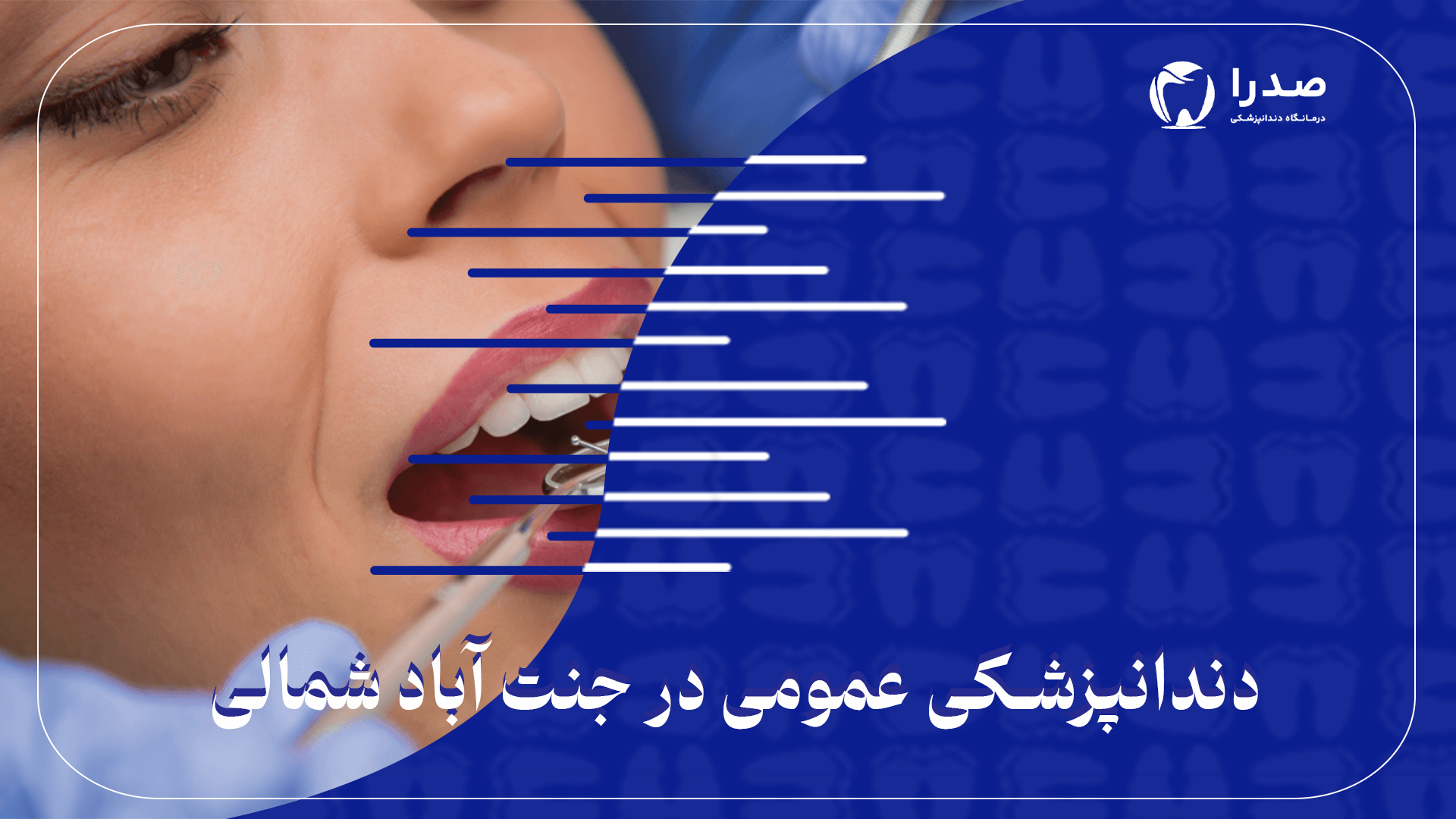 دندانپزشکی عمومی در جنت آباد شمالی دندانپزشکی عمومی در جنت آباد شمالی