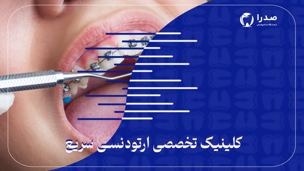 کلینیک تخصصی ارتودنسی سریع