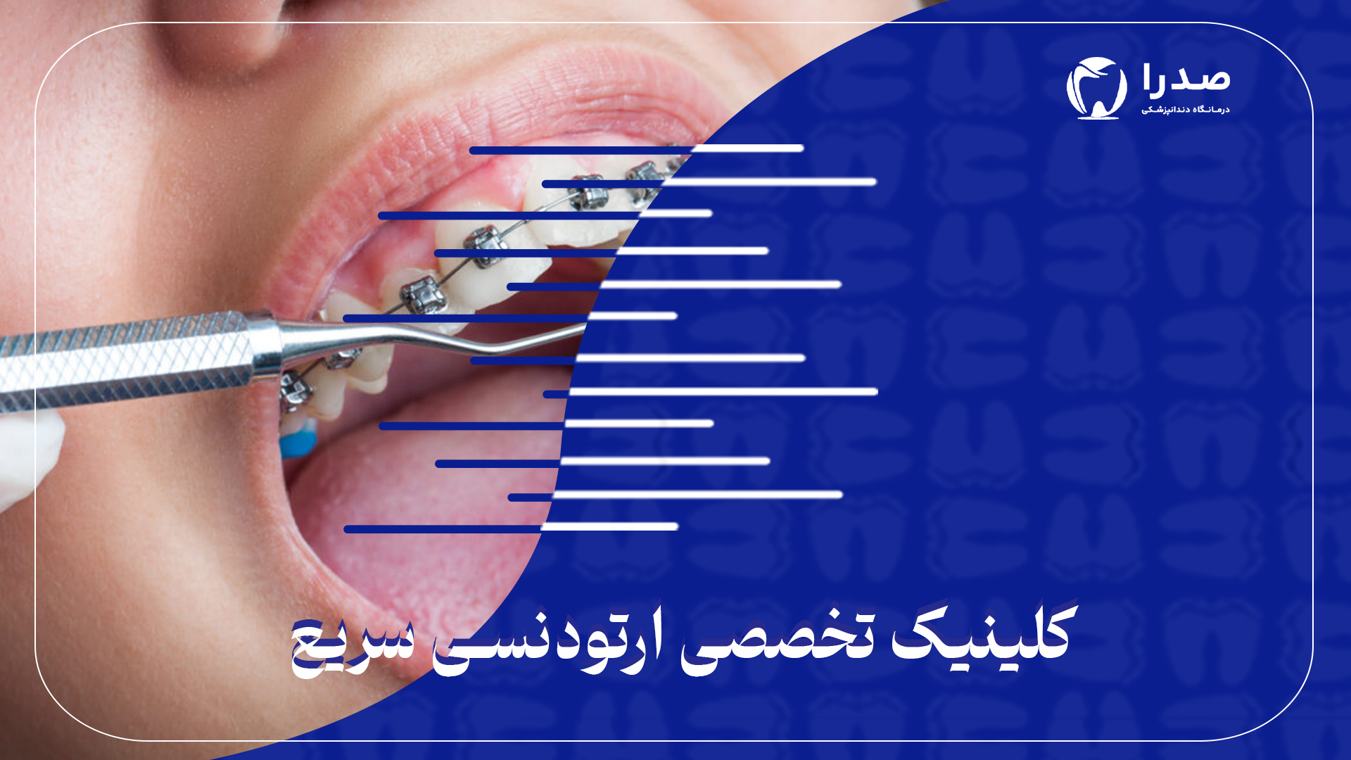 کلینیک تخصصی ارتودنسی سریع کلینیک تخصصی ارتودنسی سریع