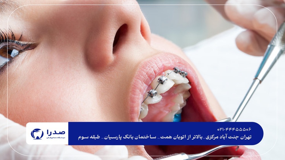 درمان های تخصصی دندانپزشکی در جنت آباد درمان های تخصصی دندانپزشکی در جنت آباد