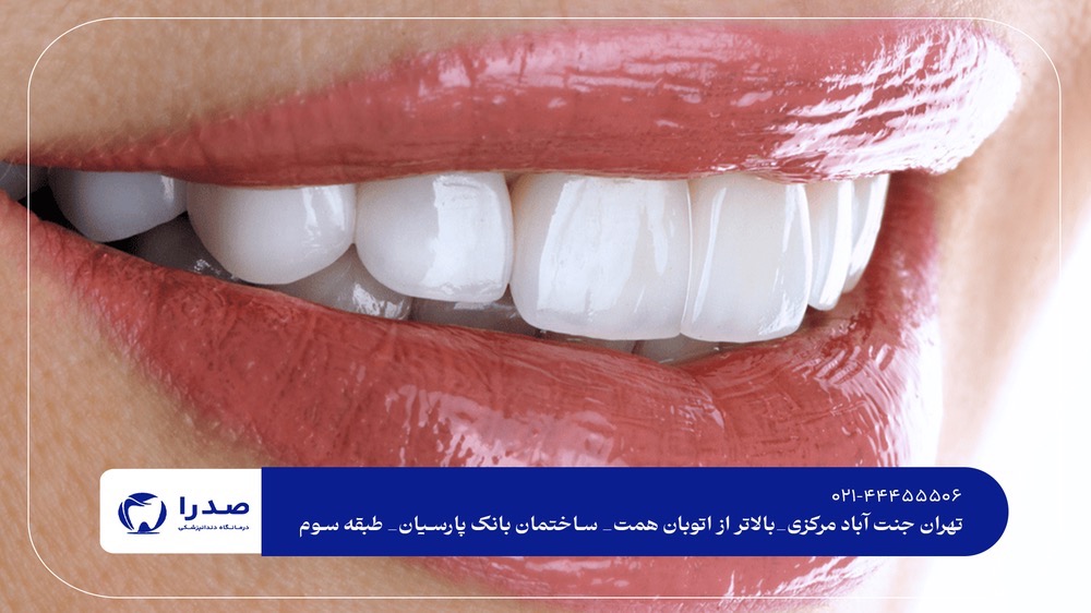 بهترین دندانپزشکی عمومی غرب تهران بهترین دندانپزشکی عمومی غرب تهران