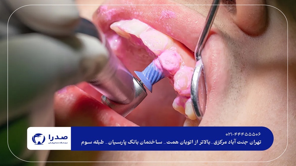 خدمات دندانپزشکی در جنت آباد خدمات دندانپزشکی در جنت آباد