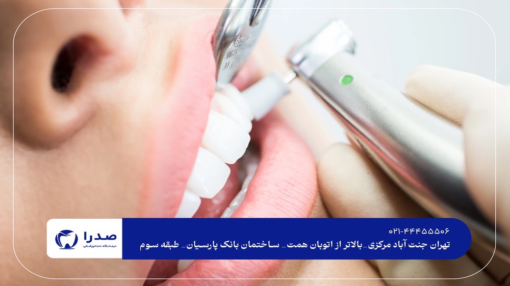 خدمات دندانپزشکی در جنت آباد خدمات دندانپزشکی در جنت آباد