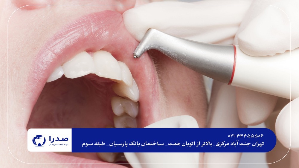 خدمات دندانپزشکی در جنت آباد خدمات دندانپزشکی در جنت آباد