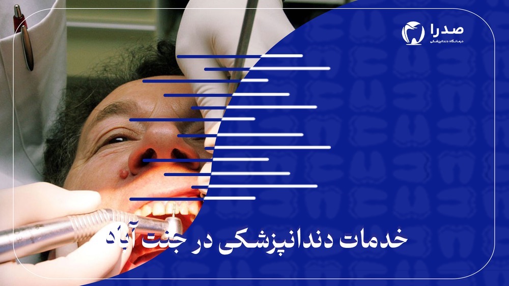 خدمات دندانپزشکی در جنت آباد