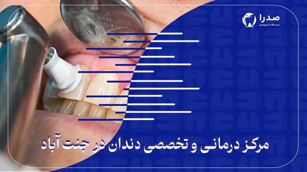 مرکز درمانی و تخصصی دندان در جنت آباد مرکز درمانی و تخصصی دندان در جنت آباد