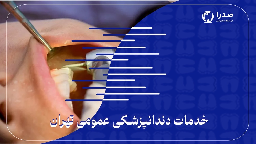 خدمات دندانپزشکی عمومی تهران خدمات دندانپزشکی عمومی تهران
