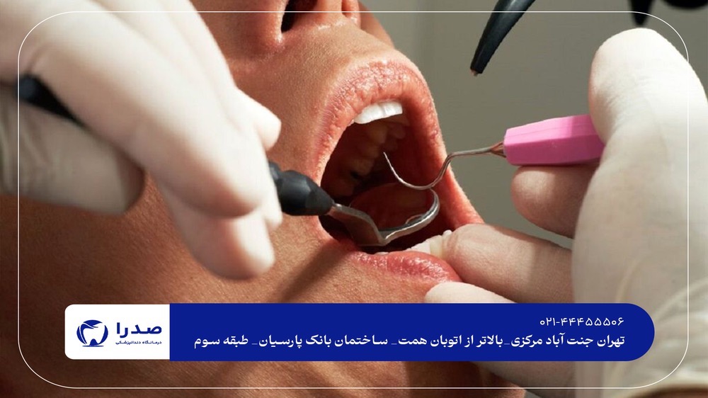 خدمات دندانپزشکی عمومی تهران خدمات دندانپزشکی عمومی تهران