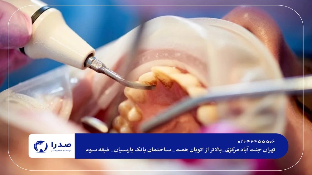 خدمات دندانپزشکی عمومی تهران خدمات دندانپزشکی عمومی تهران