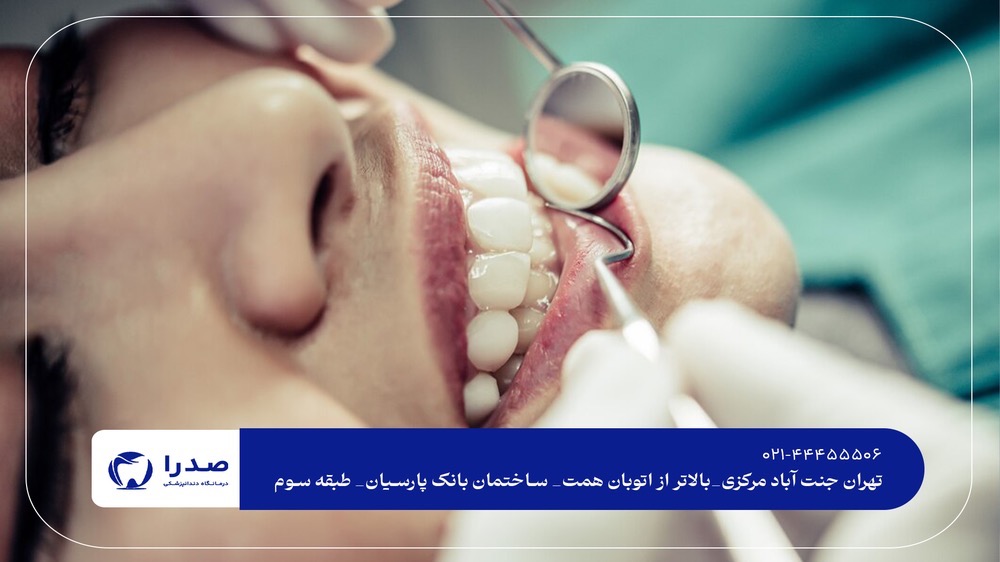 ویزیت رایگان دندانپزشکی در جنتآباد