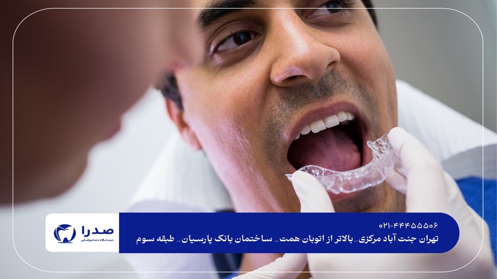 ویزیت رایگان دندانپزشکی در جنت آباد ویزیت رایگان دندانپزشکی در جنت آباد