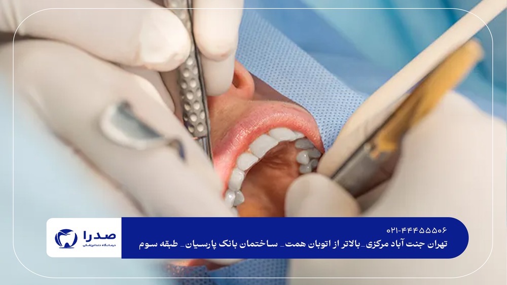 دندانپزشکی شبانه روزی در غرب تهران دندانپزشکی شبانه روزی در غرب تهران