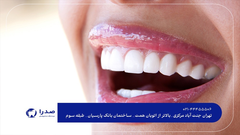 ویزیت دندانپزشکی در غرب تهران ویزیت دندانپزشکی در غرب تهران