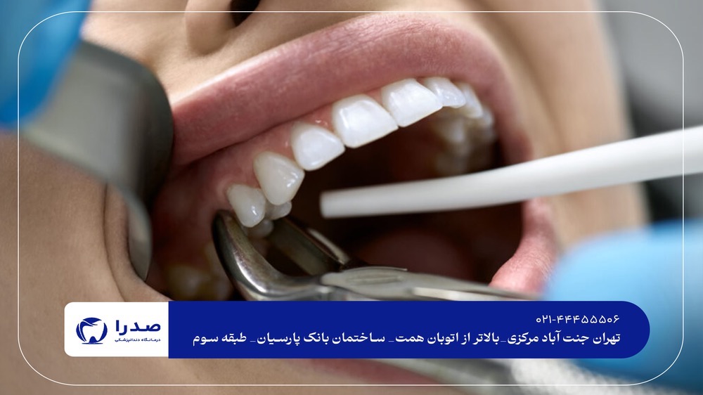 بهترین کلینیک دندانپزشکی در جنتآباد تهران بهترین کلینیک دندانپزشکی در جنتآباد تهران