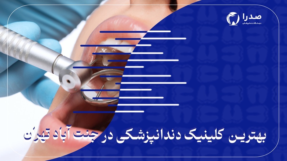 بهترین کلینیک دندانپزشکی در جنتآباد تهران بهترین کلینیک دندانپزشکی در جنتآباد تهران