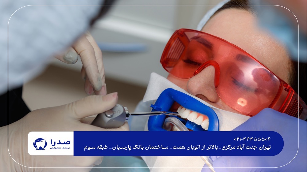 سفید کردن دندان با دستگاه حرفهای سفید کردن دندان با دستگاه حرفهای