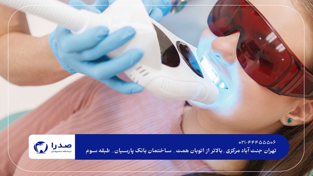 سفید کردن دندان با دستگاه حرفهای سفید کردن دندان با دستگاه حرفهای