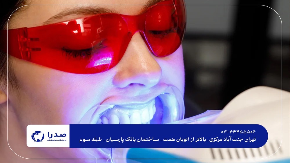 سفید کردن دندان با دستگاه حرفهای سفید کردن دندان با دستگاه حرفهای