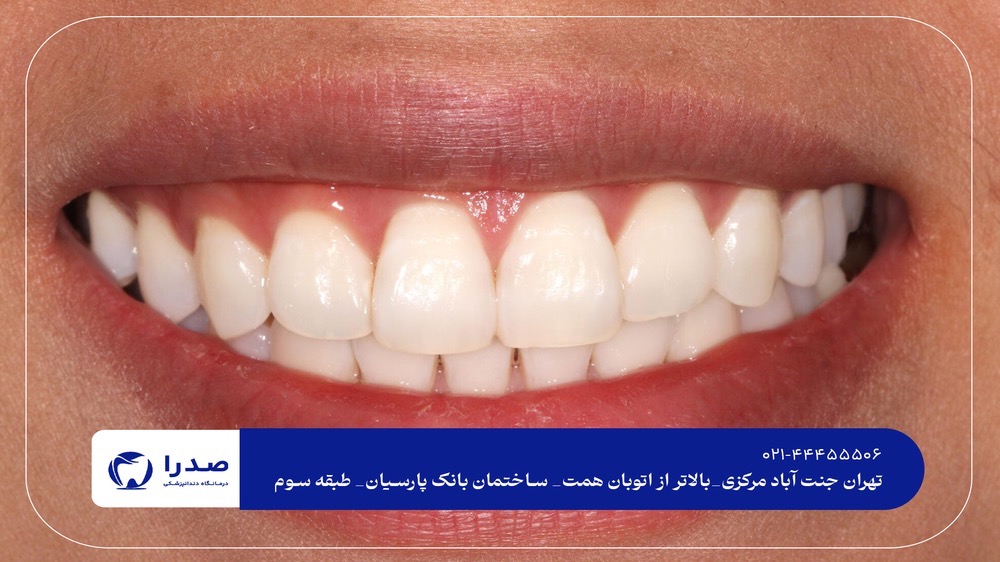 دندانپزشک متخصص زیبایی