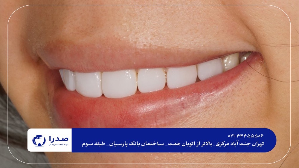 دندانپزشک متخصص زیبایی دندانپزشک متخصص زیبایی