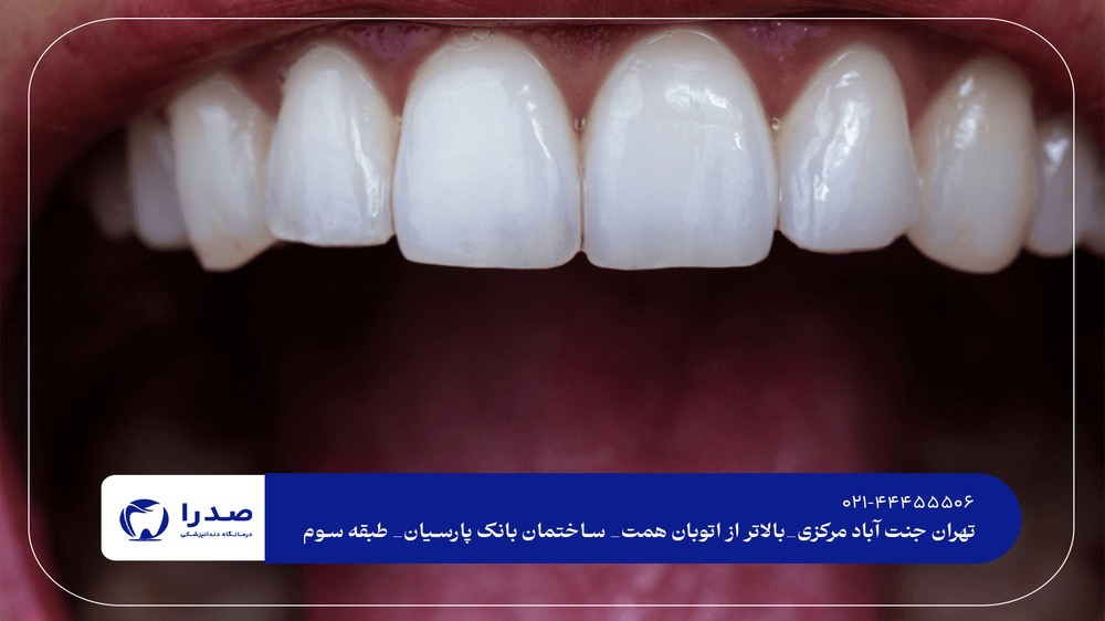 دندانپزشک متخصص زیبایی دندانپزشک متخصص زیبایی