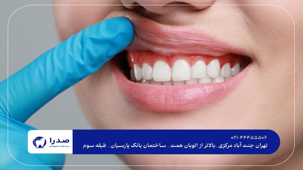 مرکز درمان عمومی دندان جنتآباد مرکز درمان عمومی دندان جنتآباد