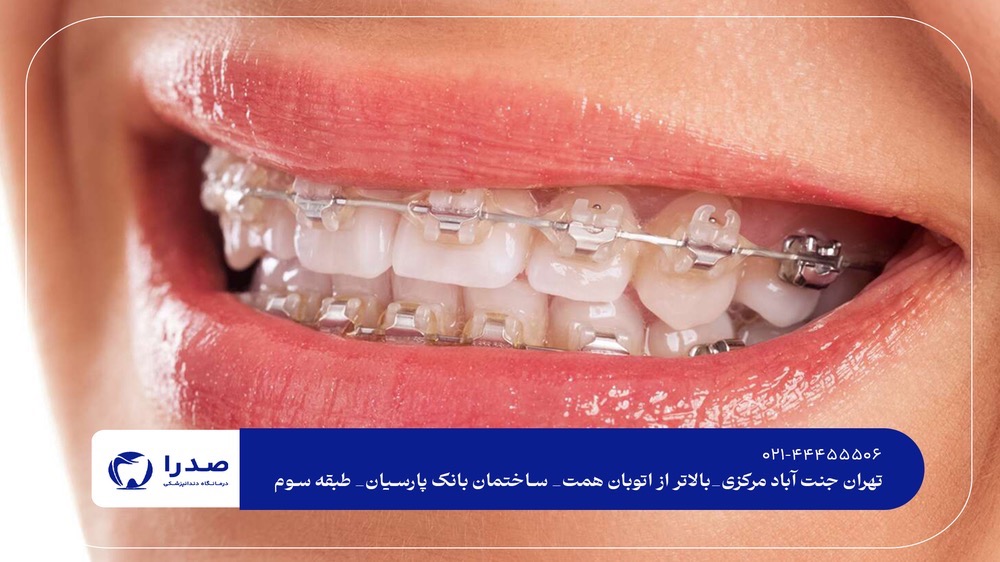 بهترین دندانپزشکی ارتودنسی در تهران