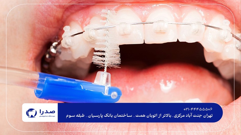 بهترین دندانپزشکی ارتودنسی در تهران