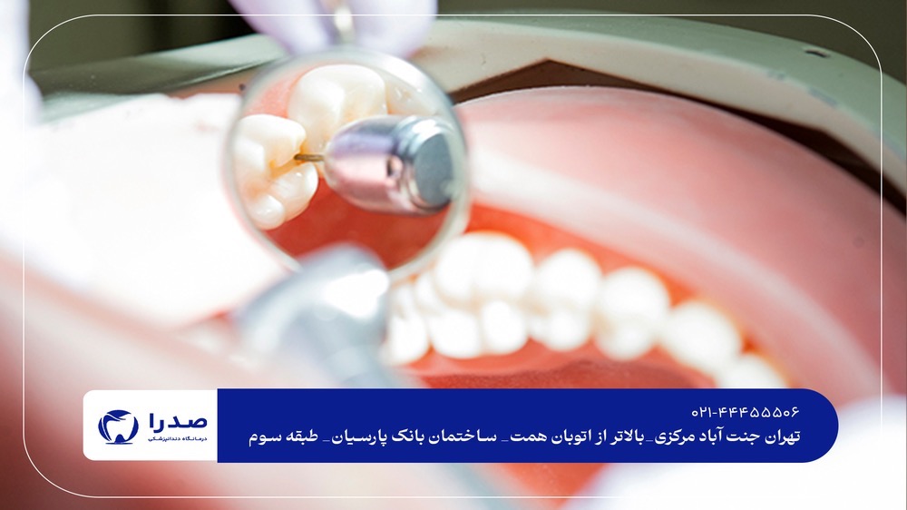 بهترین و تخصصیترین دندانپزشکی جنتآباد بهترین و تخصصیترین دندانپزشکی جنتآبادبهترین و تخصصیترین دندانپزشکی جنتآباد