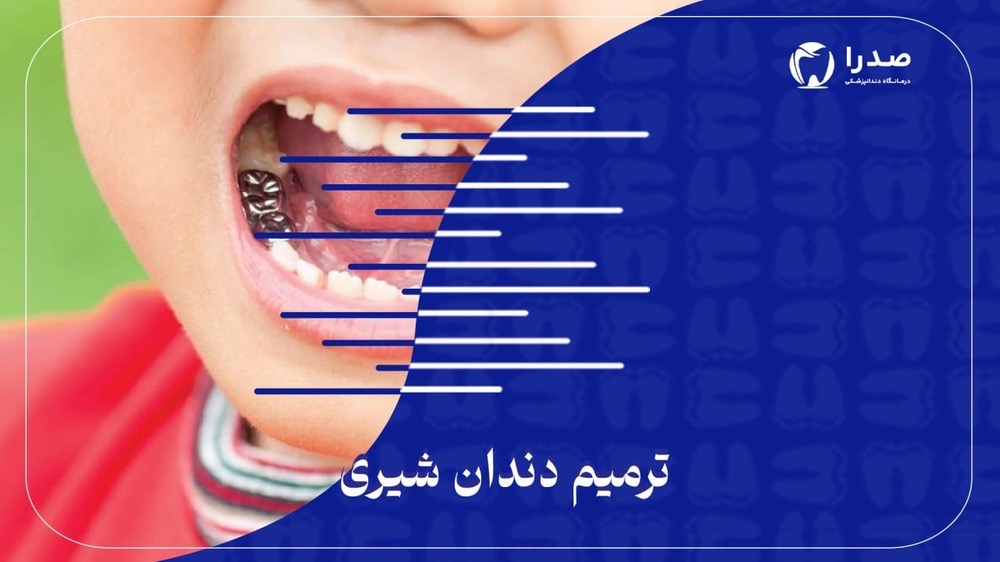 ترمیم دندان شیری ترمیم دندان شیری