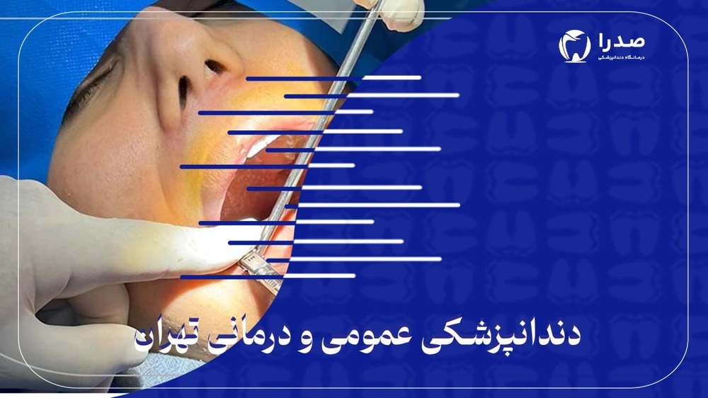 دندانپزشکی عمومی و درمانی تهران دندانپزشکی عمومی و درمانی تهران
