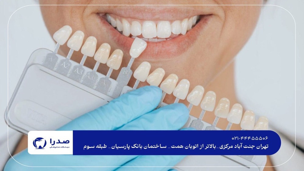  کامپوزیت و لمینت دندان